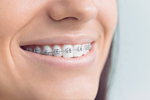 Best Dental Fillings (Composite and Amalgam)  in Irvington, NY
